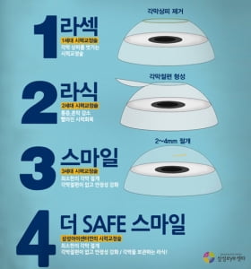 안정성에 완성도까지 더한 라식수술, 더safe스마일라식 눈길