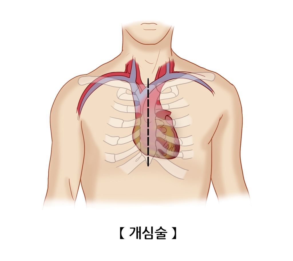 "음악, 개심술 환자 불안 진정시켜"