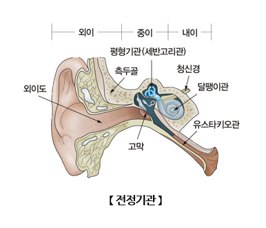 美 연구팀, 전정 기능장애 치료 임플란트 개발