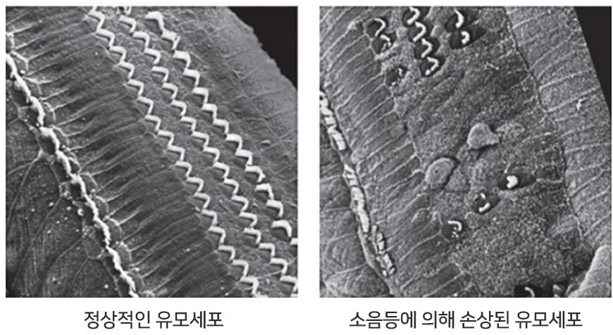 [김길원의 헬스노트] 청소년 난청 부르는 이어폰의 불편한 진실