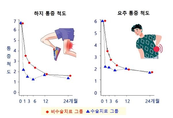 허리수술 할까, 말까…"초기 통증 호전하지만 장기적 차이 없어"