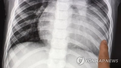 LG디스플레이, 미래 먹거리 '의료용 엑스레이 영상' 진출
