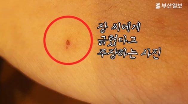 "장제원 아들 장용준이 일방적 폭행" 피해자가 공개한 사진