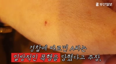 "장제원 아들 장용준이 일방적 폭행" 피해자가 공개한 사진