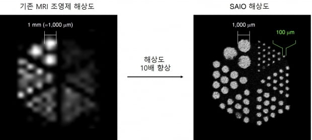 조영제 '사이오'의 크기는 5nm(나노미터) 크기로 미세혈관 직경(0.2~0.8밀리미터(mm))보다 약 1500배 정도 작아 몸속 모든 혈관을 구석구석 돌아다닐 수 있다. 또한 뛰어난 해상도를 지녀 혈관을 최대 10배 더 자세히 볼 수 있다. IBS 제
