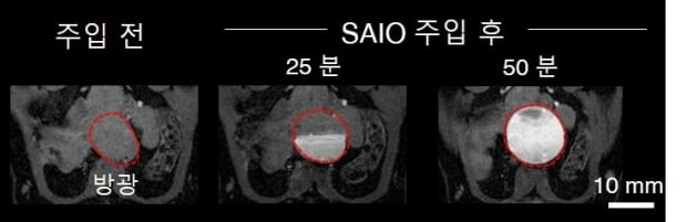 '사이오' 조영제는 동물실험에서 MRI 촬영 후 소변으로 완전히 배출됐다. 실험에서는 사이오 주입 전, 후로 쥐의 방광을 MRI로 촬영했다. 시간이 지남에 따라 사이오가 방광으로 모이는 것을 확인했고, 방광에 모인 사이오는 소변으로 배출됐다. IBS 제공