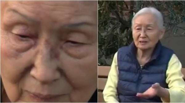 뉴욕서 83세 한인 할머니, 주먹질에 기절…증오범죄 논란