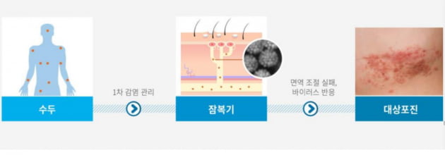 [김우섭 기자의 바이오 탐구영역] 아이진(2) "면역증강제로 차별화 .. 대상포진 백신 올해 기술이전 추진"  