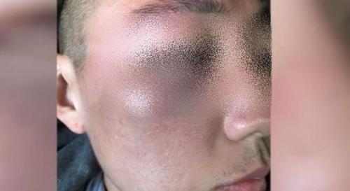 "미국내 아시아계 겨냥 증오범죄 증가는 독특한 인종적 위상 탓"