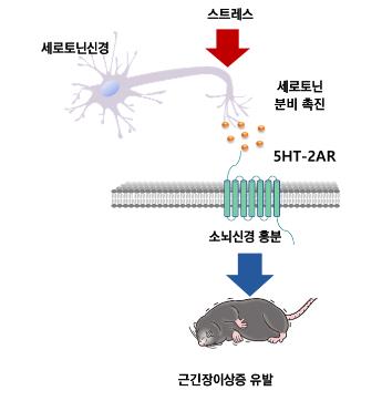 온몸 뒤틀리는 근긴장이상증 치료할 약물 찾았다