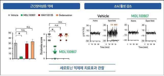 온몸 뒤틀리는 근긴장이상증 치료할 약물 찾았다