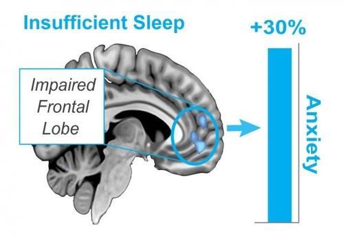 뇌의 별 모양 세포, 새로운 '수면 조절' 기능 발견