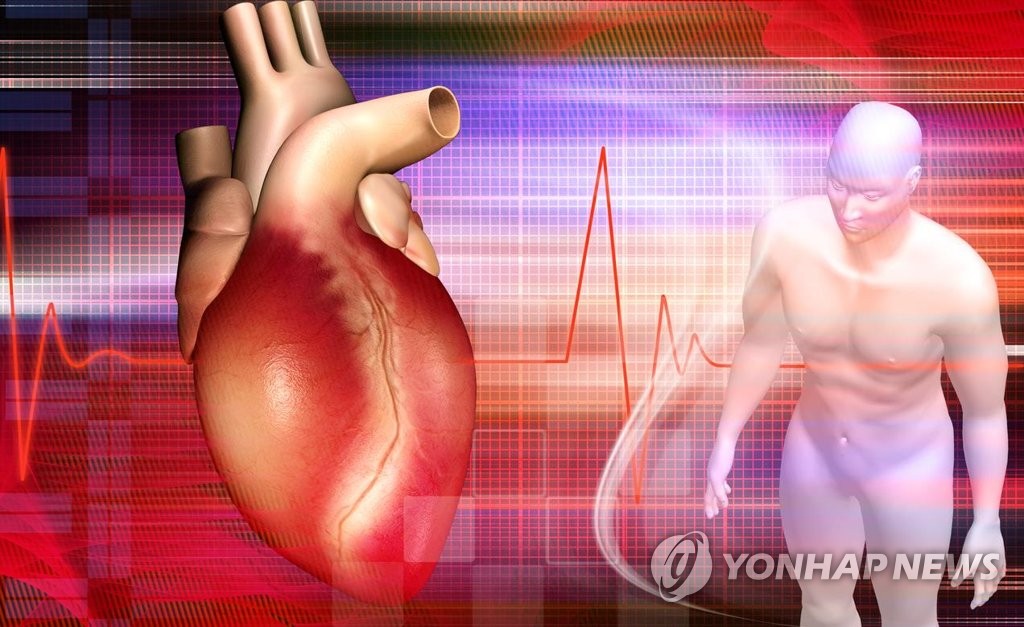 허혈성 심장질환으로 한해 94만명 진료…"방치하면 급사 위험"