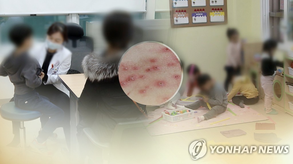 GC녹십자 美자회사, HIV 소아용 수두백신 임상 1b상 허가받아