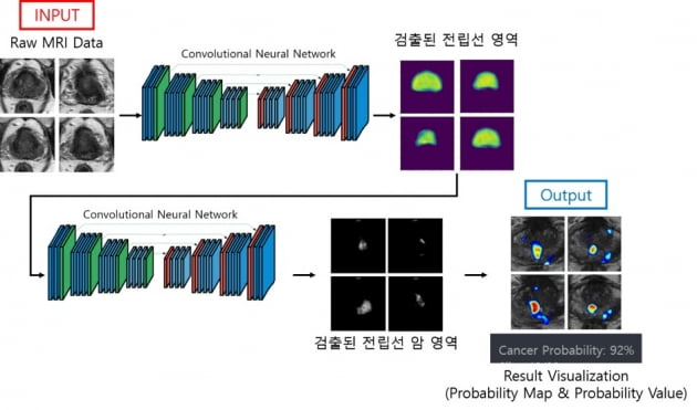 제이엘케이, 전립선암 진단보조 소프트웨어 식약처 허가