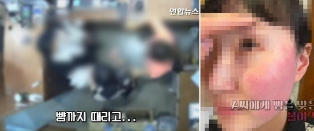 폭행 혐의로 경찰 조사를 받고 있는 주한 벨기에 대사 부인에게 뺨을 맞은 피해자인 옷가게 점원과 가족이 볼이 부은 사진과 폭행 당시 CCTV 영상을 지난 20일 공개했다/사진=연합뉴스
