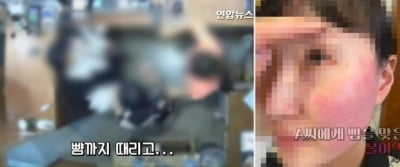 벨기에 대사 부인 퇴원 "경찰 조사 받을 것"