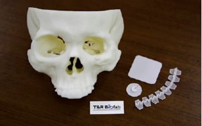 티앤알바이오팹, 뼈재생 돕는 3D 프린팅으로 中·유럽 진출