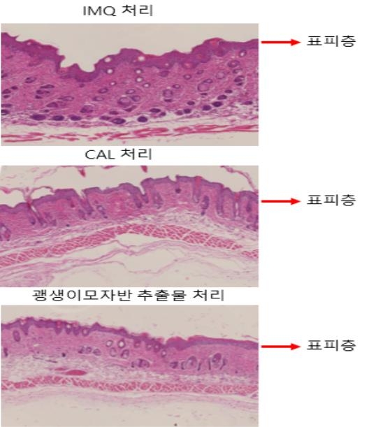 괭생이모자반에서 피부질환 개선 효능 발견…특허출원