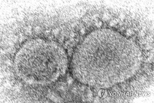 영국발 변이 코로나, 미 50개 주 전체 확산…1만5천건 확인