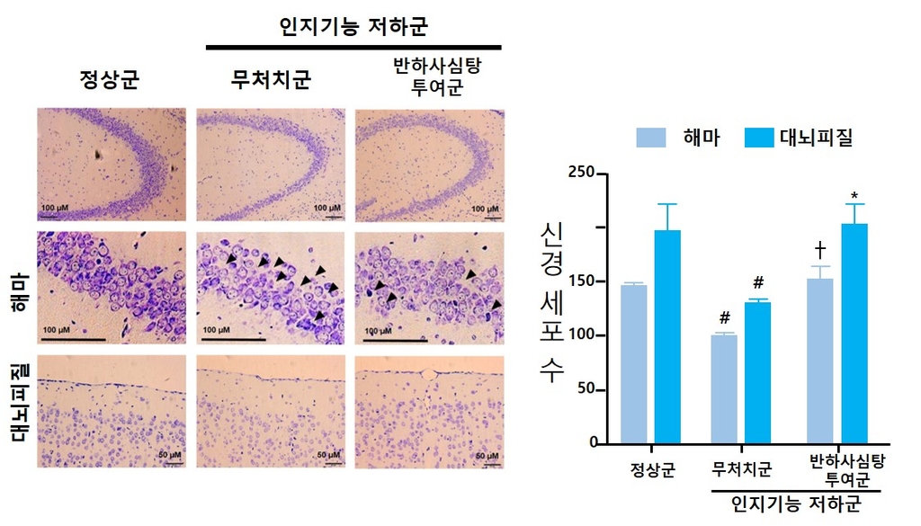 한의학연 "한약 제제 3종 치료 범위 확대 위한 임상시험 승인"