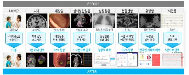 의사대신 AI닥터가 폐렴·간암·당뇨 등 12개 질환 진단한다