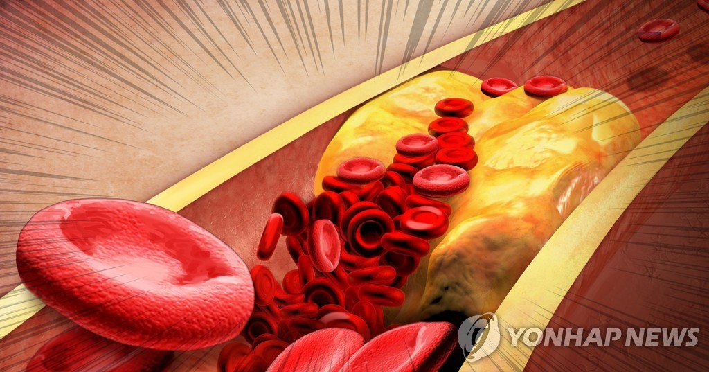 질병청, 병원 등 대상 '만성질환 진단검사' 정확성 평가