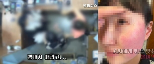 폭행 혐의로 경찰 조사를 받고 있는 주한 벨기에 대사 부인에게 뺨을 맞은 피해자인 옷가게 점원과 가족이 볼이 부은 사진과 폭행 당시 CCTV 영상을 20일 공개했다. 사진=연합뉴스