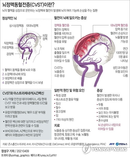 백신 연관성 인정된 '희귀혈전증'은…"국내서는 아직 발생 안해"