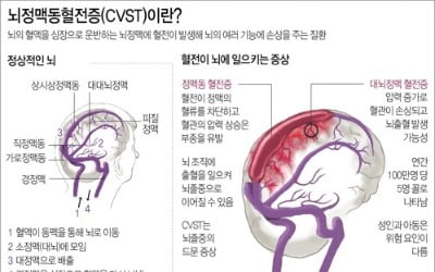 백신 연관성 인정된 '희귀혈전증'은…"국내서는 아직 발생 안해"