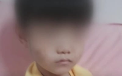 4살 아이 얼굴 '멍투성이'인데…경찰 "학대 증거 없다"