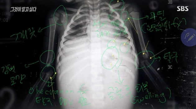 '정인이 양모 못지않다'…'잔인한 방관' 일삼은 양부 행각