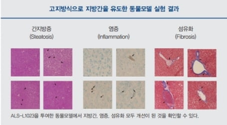 [Cover Story - COMPANY] 안지오랩, 혈관신생 억제하는 천연물로 NASH 정복 도전