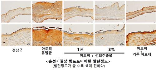 동의보감 속 매미 허물, 아토피 피부염 개선 효과 입증