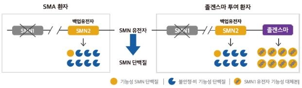 '1회 투여 25억원' 척수성 근위축증 치료제 '졸겐스마주' 허가