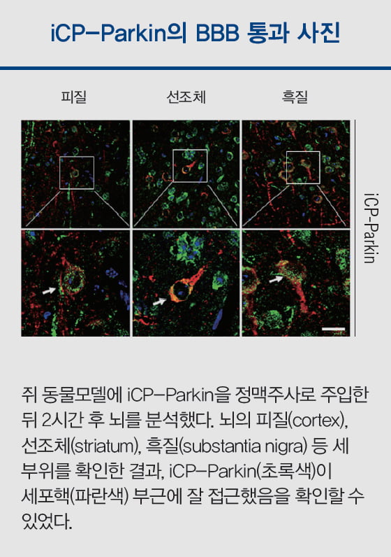 [Cover Story - part.5] 뇌세포 ‘프리패스’로 통과, 고장 난 청소부 살려 알츠하이머 치료 나서는 셀리버리