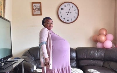 세계 최초 열쌍둥이 낳았다던 남아공女, 정신병원에 입원 [박상용의 별난세계]