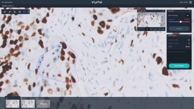 뷰노, 디지털 병리 분석 AI 솔루션 식약처 인증 획득