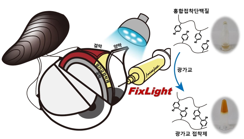 손상 눈 결막 홍합접착단백질·양막으로 재생