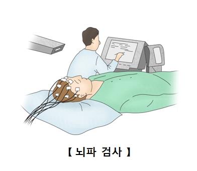 "치매 환자, 뇌파 중 감마파가 약하다"