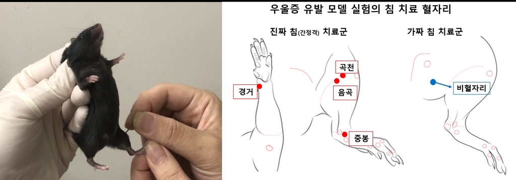 "한방 침 치료로 우울증 개선"…행동 반응 76% 증가