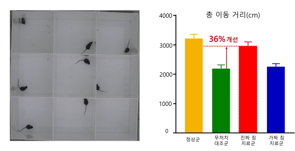 "한방 침 치료로 우울증 개선"…행동 반응 76% 증가