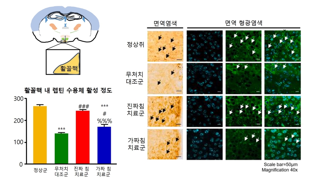 "한방 침 치료로 우울증 개선"…행동 반응 76% 증가