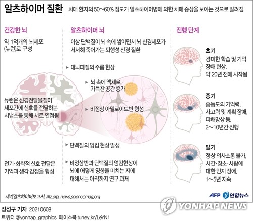 FDA 전 자문위원 "알츠하이머 신약 효과 증거없어"