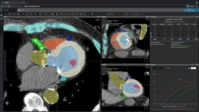 코어라인소프트 "심장질환 AI 진단 솔루션, 3등급 허가 획득"