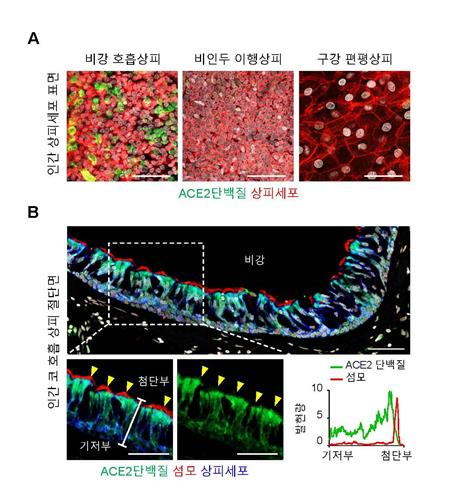 코로나19 감염 코 안에서 시작…"비강에 직접 백신 투여해야"