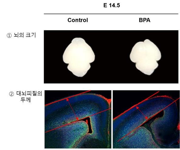 "임신 중 비스페놀A 노출되면 태아의 뇌 인지기능 떨어져"