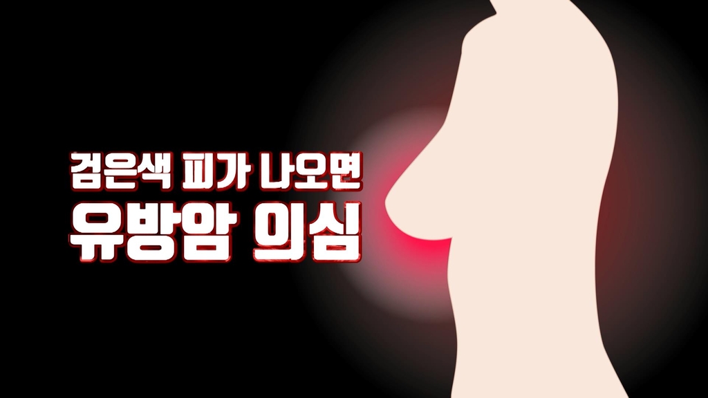 [김길원의 헬스노트] 서울대암병원이 공개하는 유방암의 모든 것-①