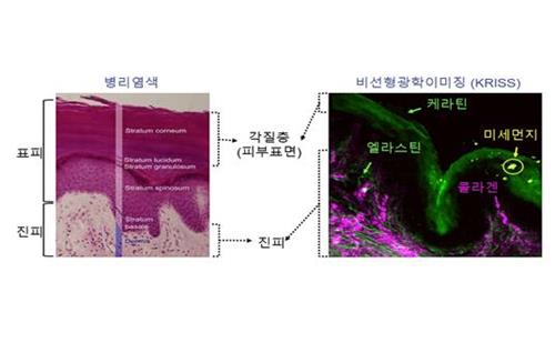 각질 손상된 아토피 피부, 미세먼지에 더 치명적…염증 악화