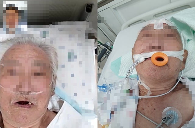 "비장 파열에 갈비뼈 골절"…80대 노인 학대한 중국인 간병인
